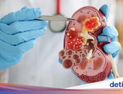 10 Tanda yang Muncul Pada Ginjal Bermasalah, Bengkak-Rasa Gatal Di Kulit