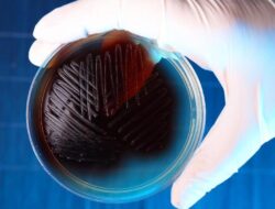 Bakteri Ini Makin Kebal! 45 Persen Antibiotik Ke Indonesia Tak Bisa Membunuhnya