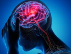 Soal Stroke Hingga Usia Muda, Ahli Kepuasan Saraf Minta Tak Anggap Sepele Kebiasaan Ini