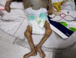 Ahli Kebugaran Ceritakan Ngerinya Situasi Warga Termasuk Anak-anak Hingga Gaza yang Kelaparan Global Global