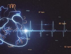 Ahli Kebugaran Spesialis Kurang, Anak Pengidap PJB Harus Tunggu 2 Tahun Bagi Operasi