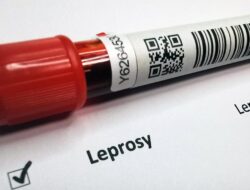 Kronologi WNI Di Rumania Terkena Kusta, Dari Sebab Itu Peristiwa Pidana Pertama usai 44 Tahun