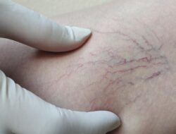 Bersila usai Latihan Bikin Varises, Mitos atau Fakta? Ini Penjelasan Ahli Kepuasan