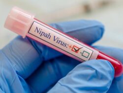 Bikin India Ketar-ketir, Sefatal Ini Tanda Pasien Positif Patogen Nipah