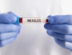 Kemenkes RI Terima Notifikasi Di Australia Yang Berhubungan Bersama 2 Perkara Pidana Hukum Campak, Ini Kronologinya