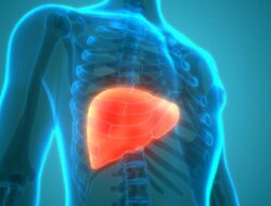 Usia 30-an Kini Banyak yang Kena Fatty Liver, Gejalanya Sering Terabaikan