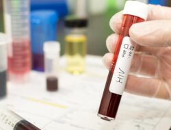 Ramai 522 Pelajar Di Sidoarjo Disebut Idap HIV, Dinkes Ungkap Data Sebenarnya