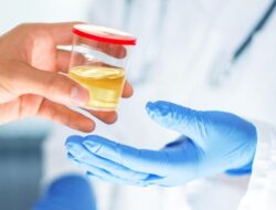 Jangan Diabaikan, Warna Urine Seperti Ini Bisa Karena Itu Tanda Ginjal Rusak